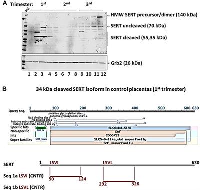 Gestational Age Variation in Human Placental Drug Transporters